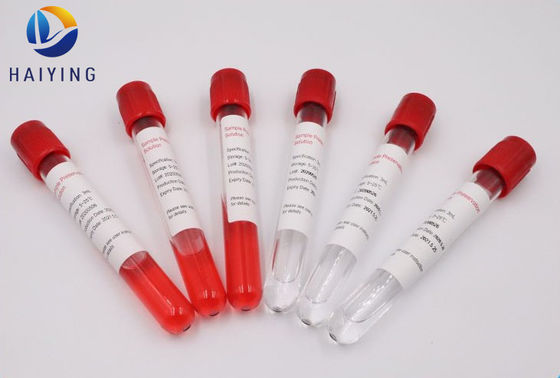 에틸렌 옥사이드 5 ml/10ml 혈액 견본은 바이러스 독감 검사를 관을 답니다